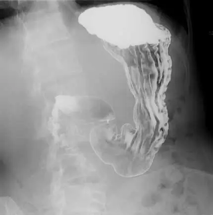 Can CBD Help Athletic Performance In 2024? 2 Xray